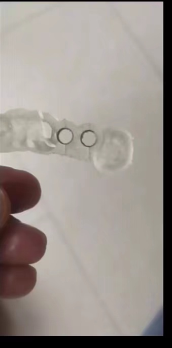 Żywica dentystyczna drukarka 3 – 3D Printing Dental recenzja i cena