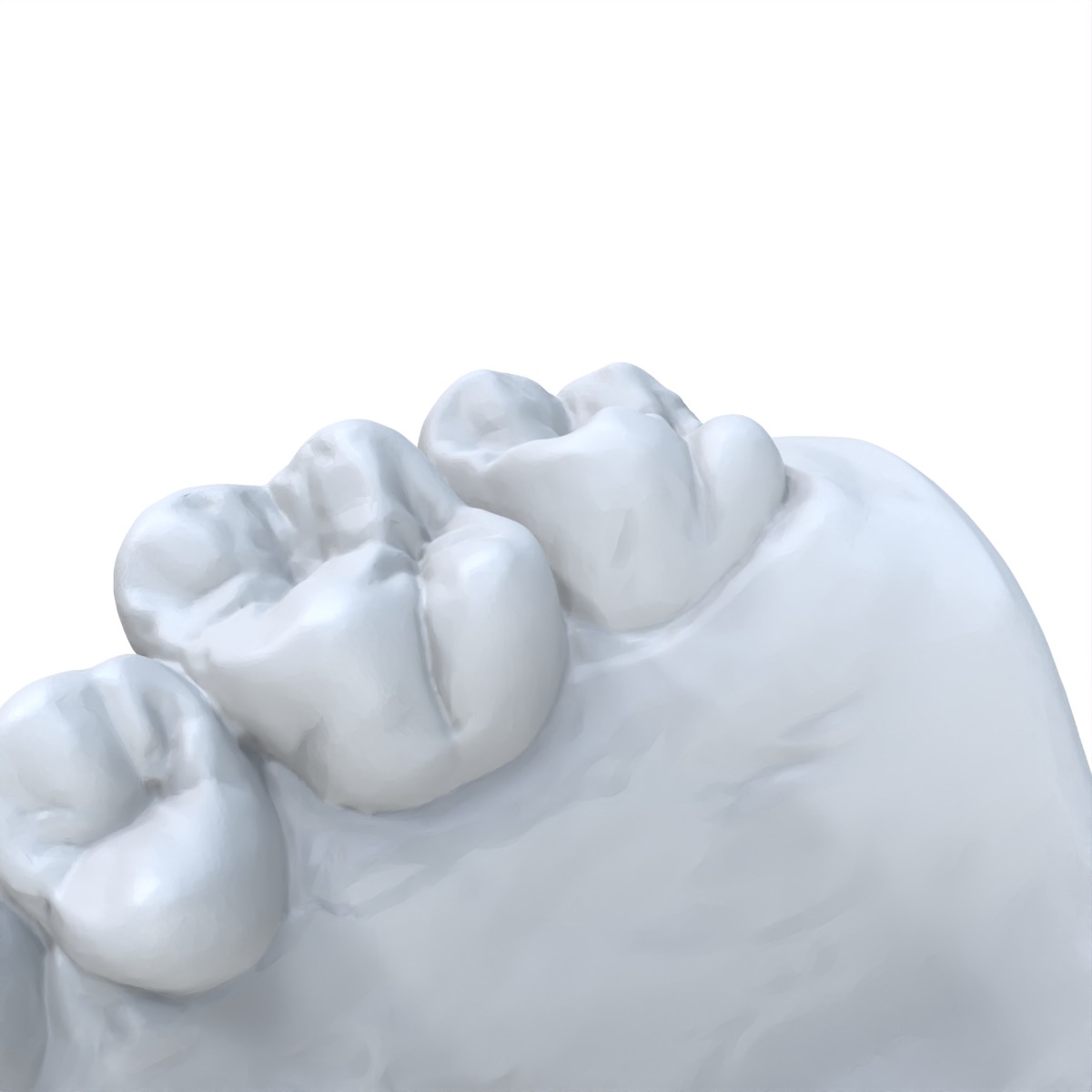 1 SZT. Model dentystyczny, pre – 3D Printing Dental recenzja i cena